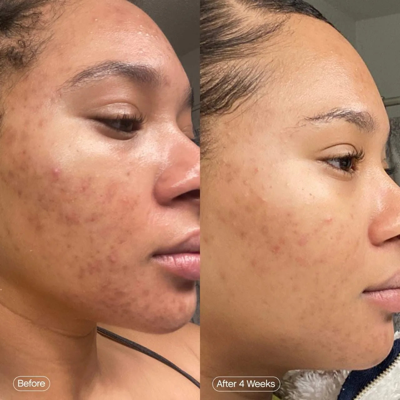 Crème Topicals Faded - Soin Anti-Taches & Éclat Visage